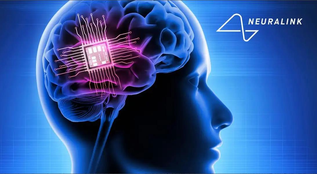 Neuralink脑植入芯片技术突破 但安全性与透明度引质疑