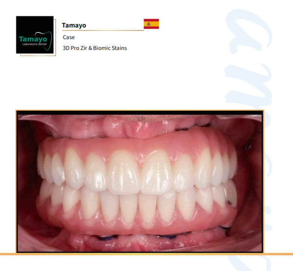 听说Aidite 3D Pro zir这款牙科材料风靡国际口腔科！到底有哪些过人之处！