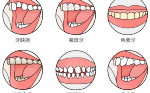 牙贴面选什么材质比较好？