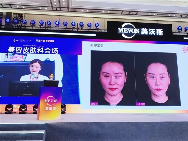 “仿生肽巨頭”：Caregen子品牌德瑪莉的千億抗衰野望